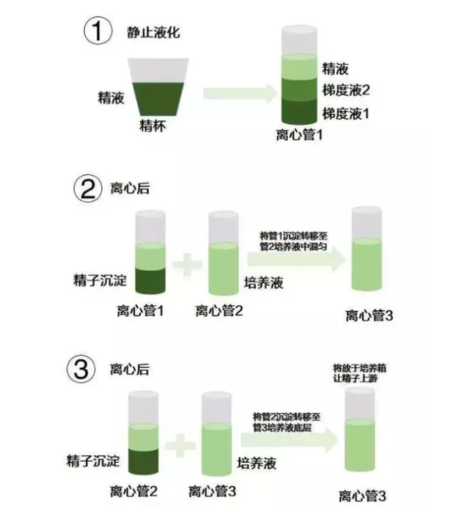 精子洗涤技术.png
