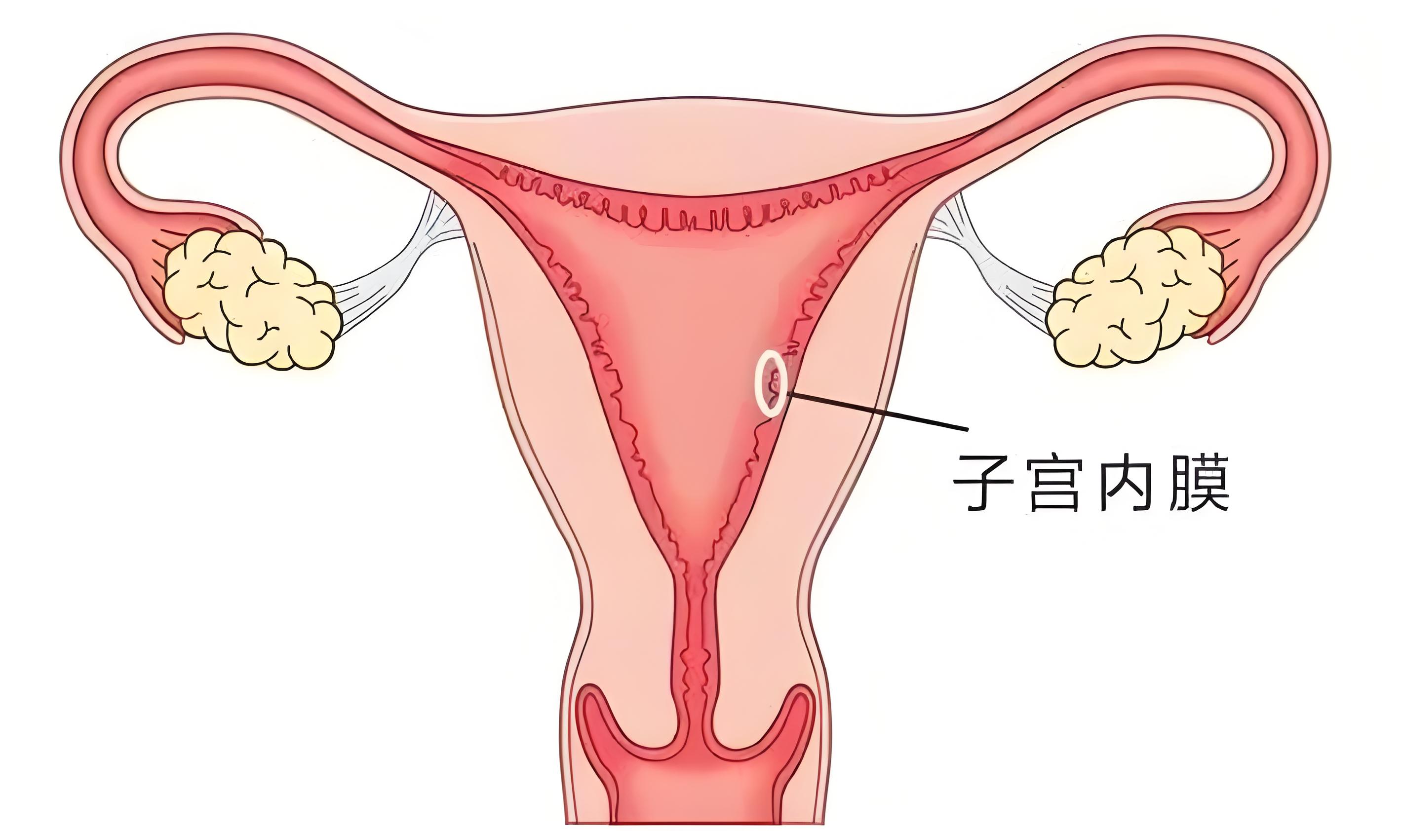 子宫内膜因素