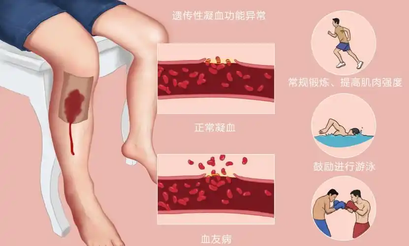 血友病