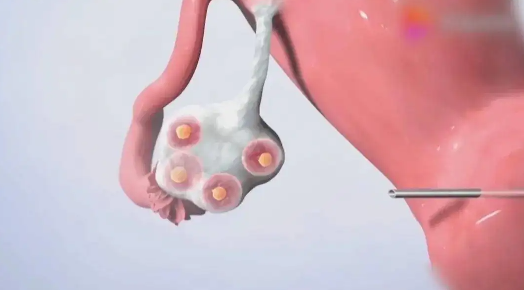取卵.png