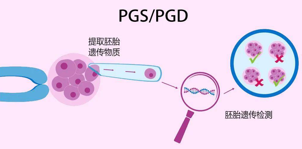 囊胚基因筛查挑选.png