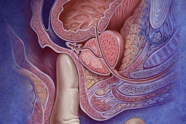 男性前列腺炎.jpg