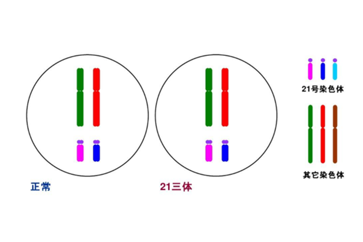 三体染色体