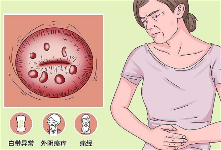 宫颈囊肿
