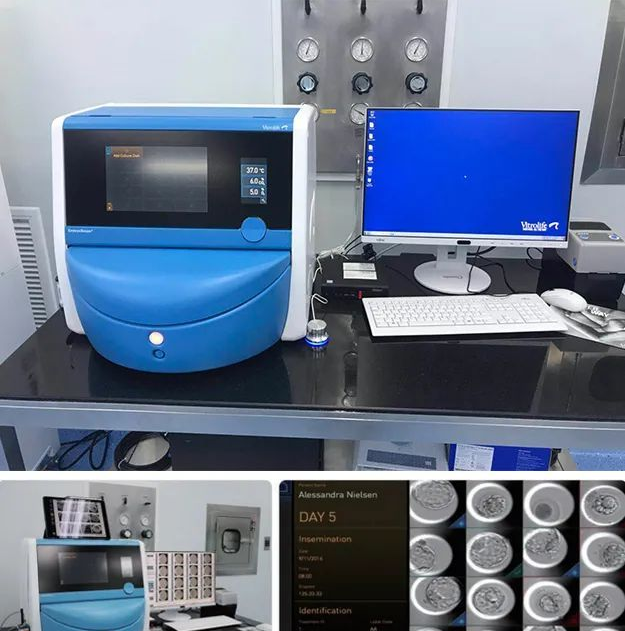 Embryoscope+