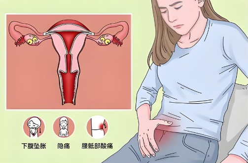 卵巢囊肿