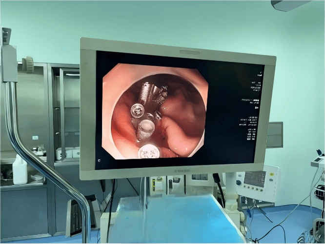 日本内视镜技术