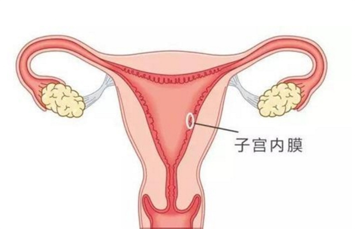 子宫内膜容受性差