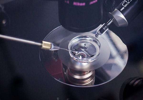 压电式胞浆内单精子注射技术