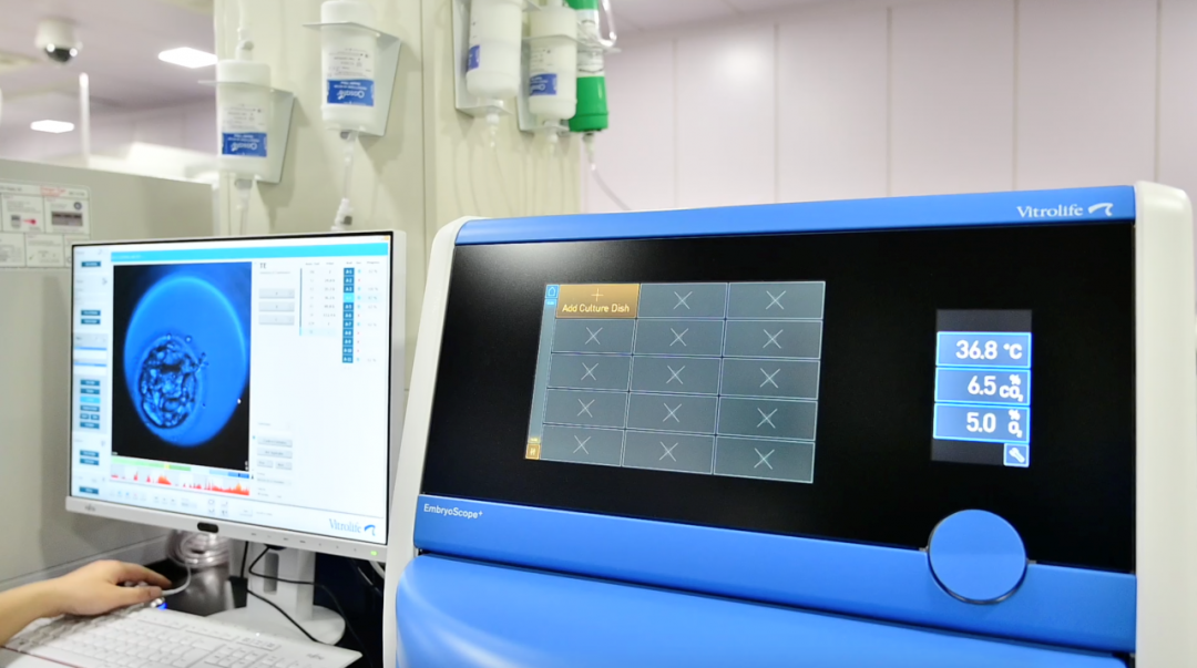 胚胎实时监测系统