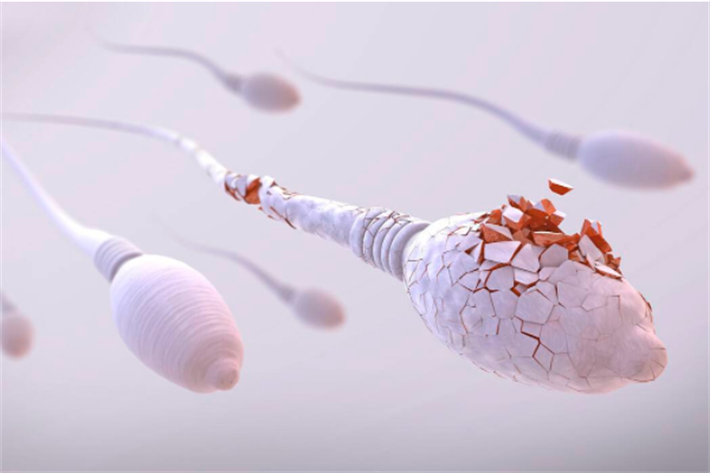 精子DNA碎片率增加