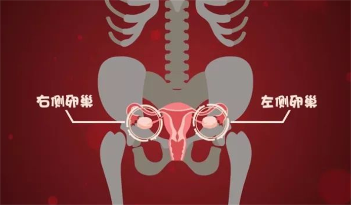 卵巢囊肿