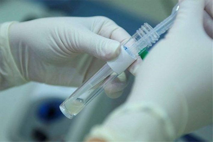 男性精子检查