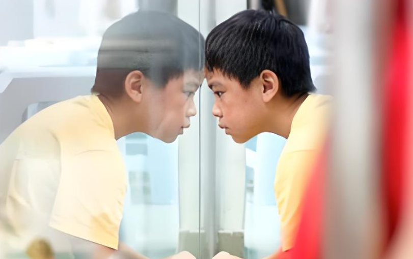 超雄综合征