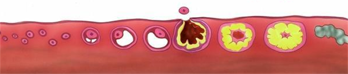 科学促排卵