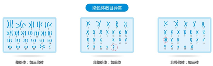 染色体数目异常