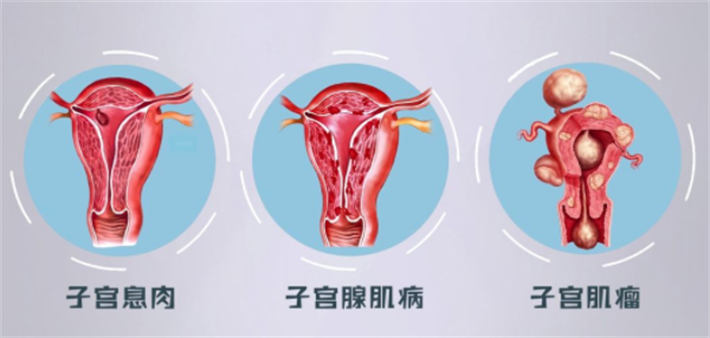子宫环境