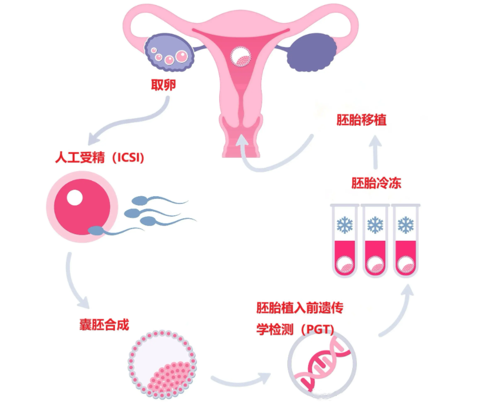 试管婴儿流程.png