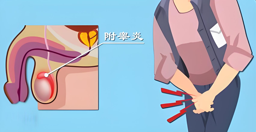 附睾炎