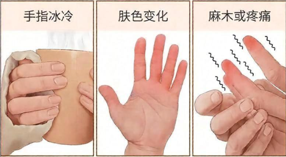 雷特综合征的临床表现