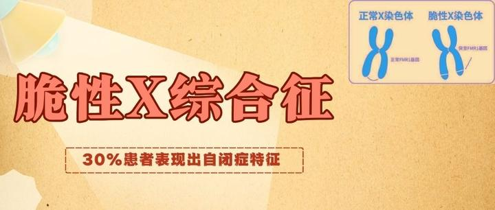 脆性X综合征