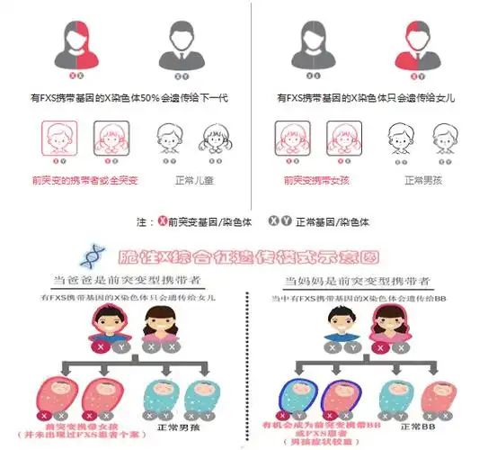 脆性X综合征