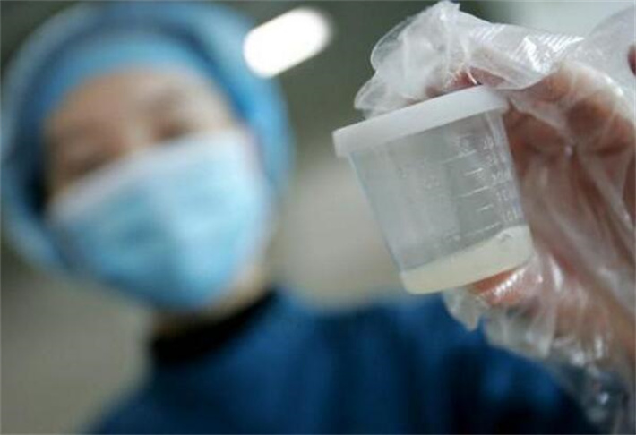 男性精液分析