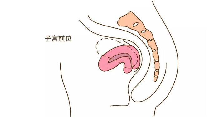子宫前位
