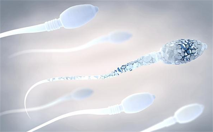 精子DNA碎片高