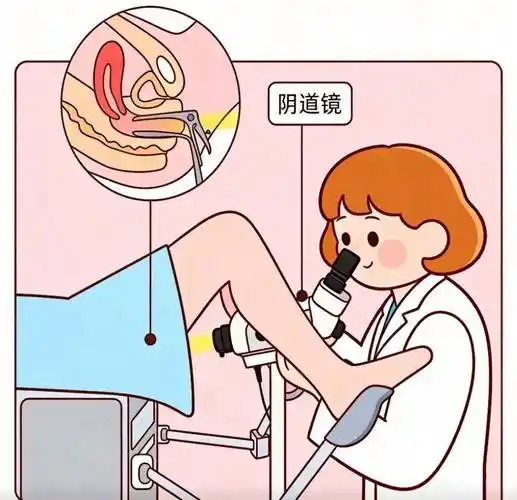 阴道镜检查